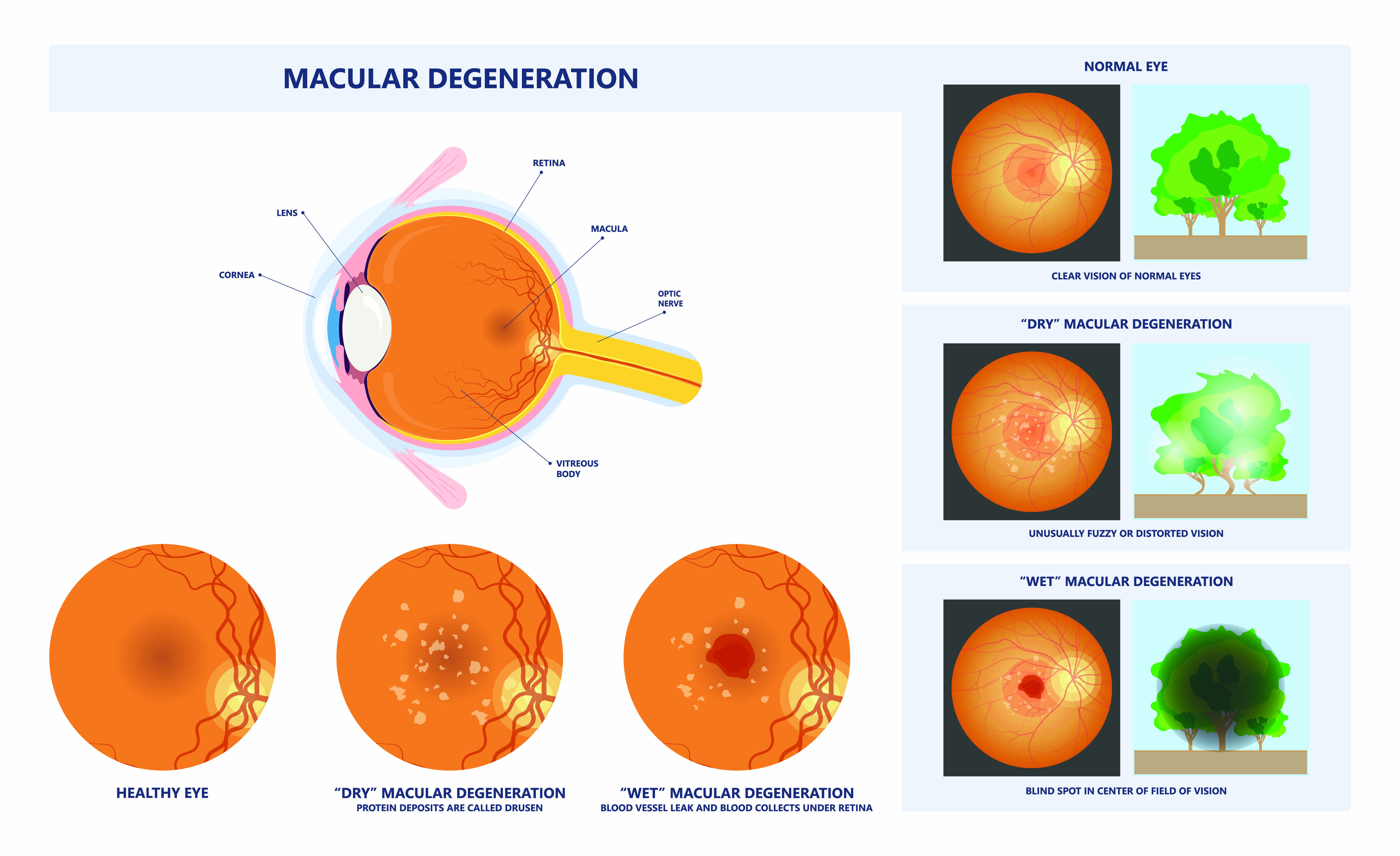 Layers of the Retina - Discovery Eye Foundation