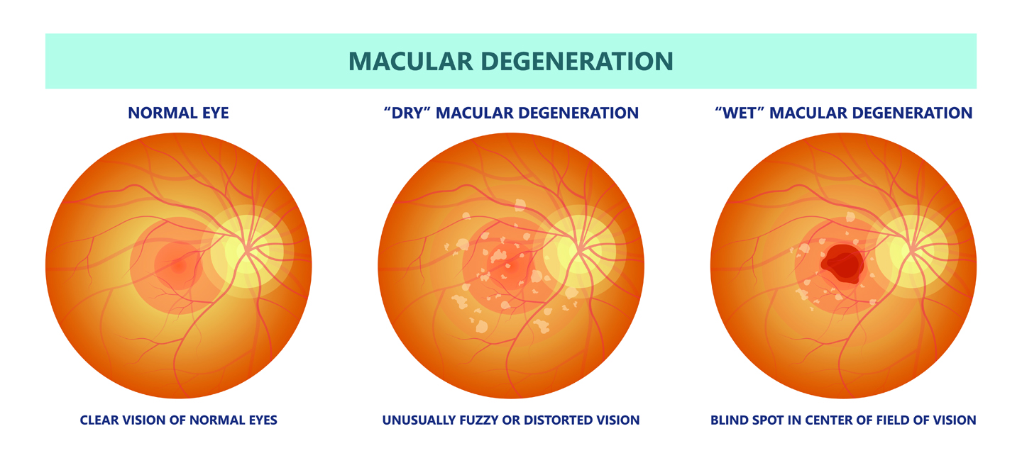 Anatomy Lesson: What Is the Retina? - Eye Care Specialists