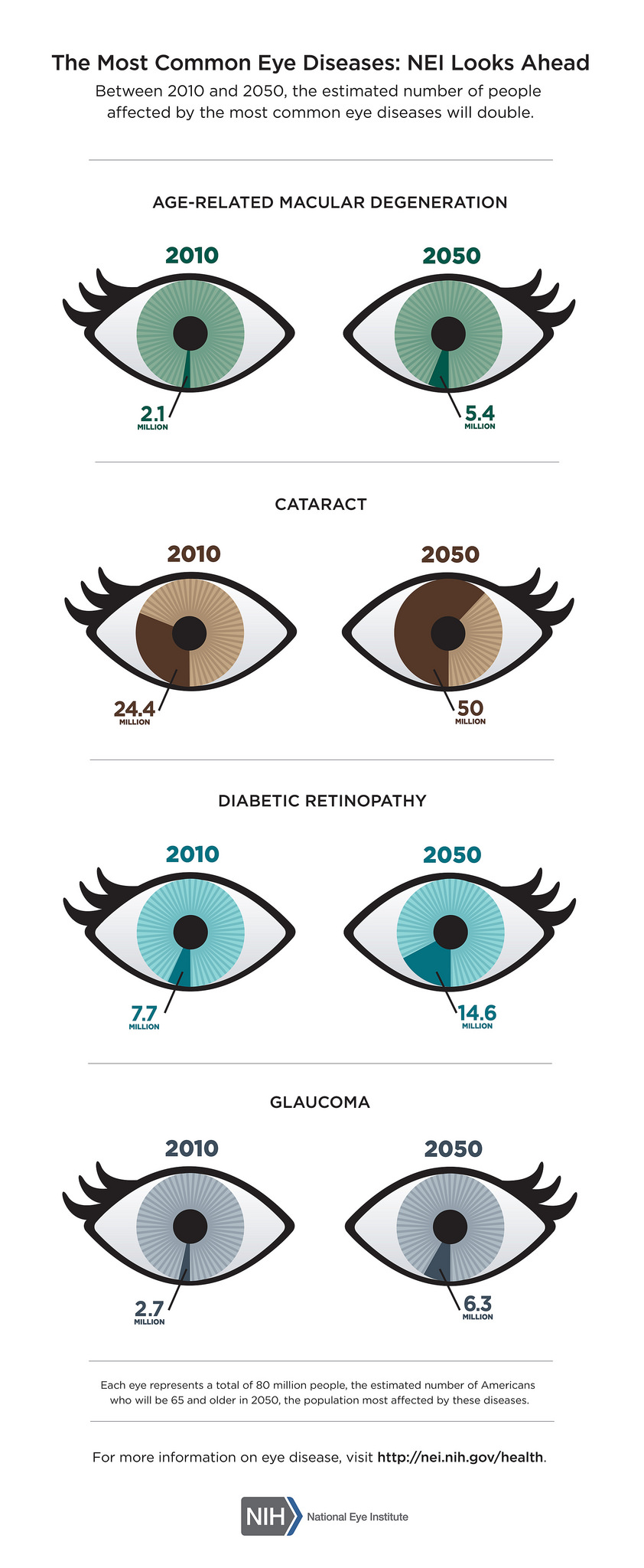 Common Eye Disease by NIH 11.10.15 - Discovery Eye Foundation