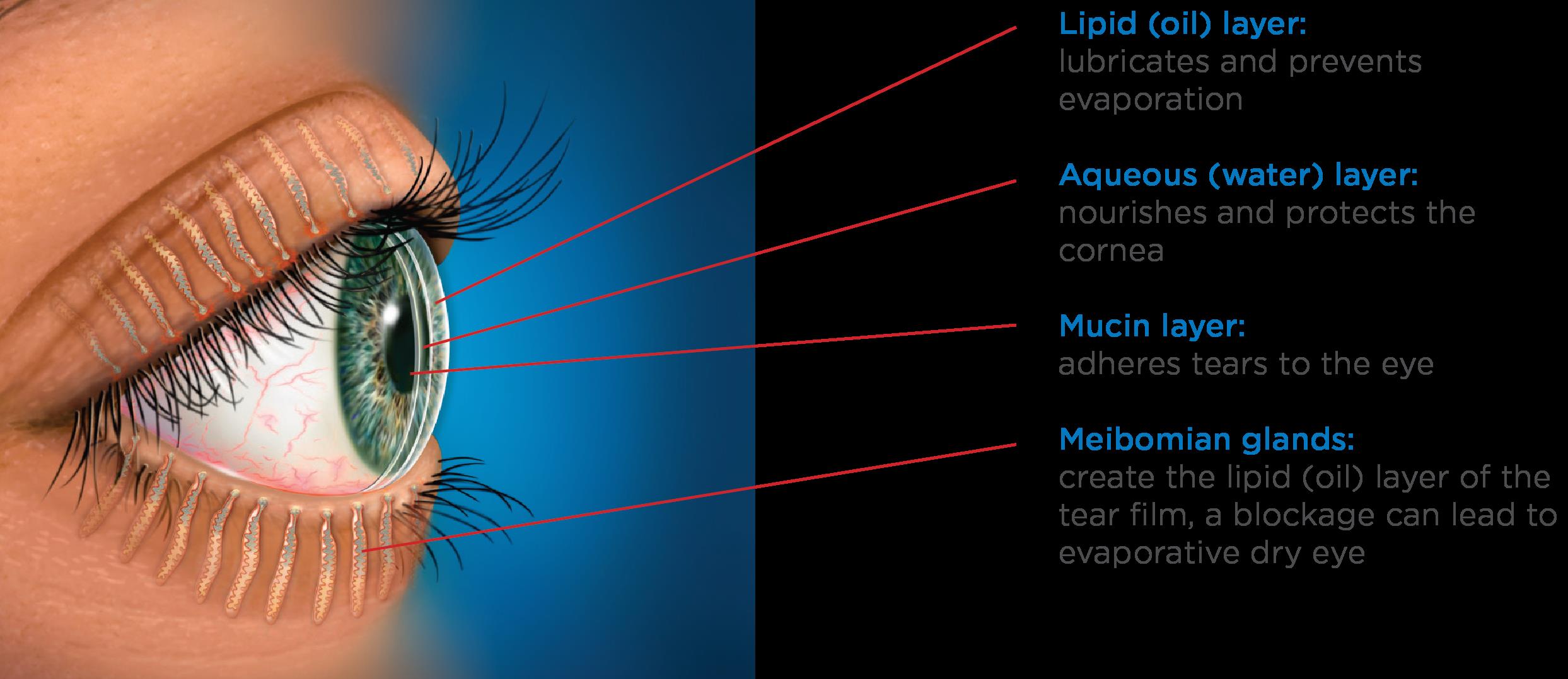 Tear Film Health is Essential for People with Keratoconus