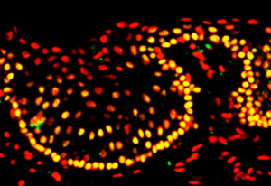 Limbal stem cells from the human cornea, with a protein known as p63 stained yellow. Cell nuclei (which hold the DNA) are stained red.  From eurostemcell.org