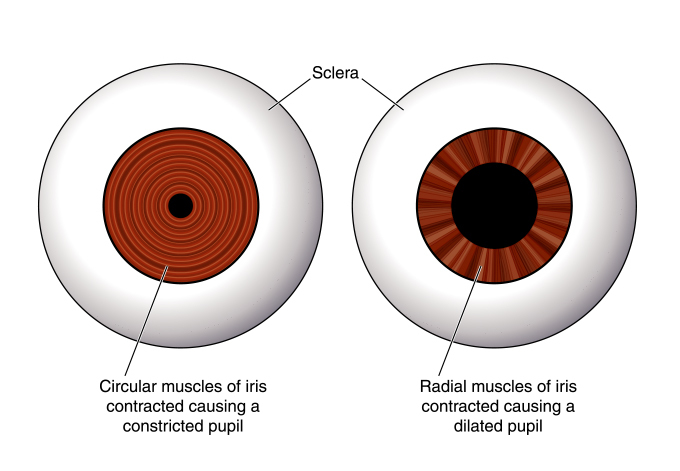 mental illness with unequal pupil size