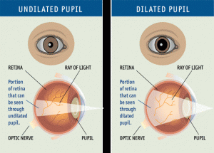 dilated eye - eye exam